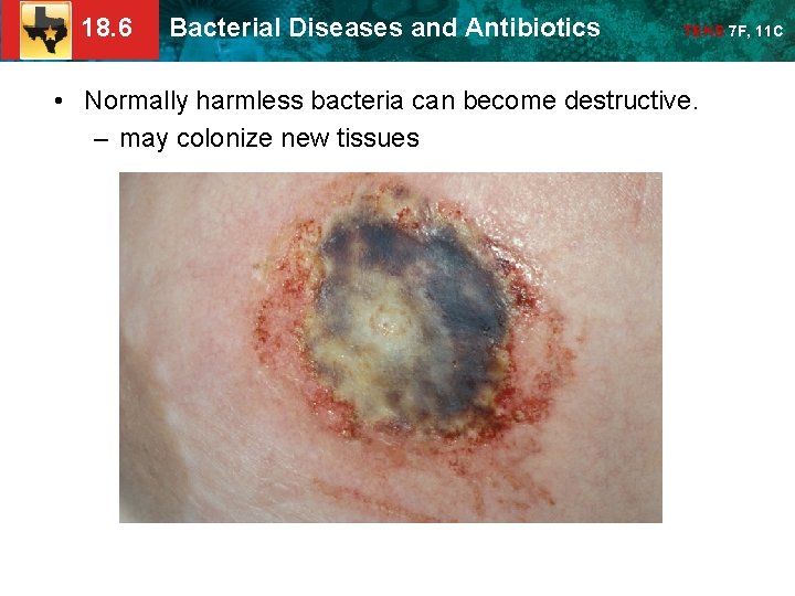 18. 6 Bacterial Diseases and Antibiotics TEKS 7 F, 11 C • Normally harmless