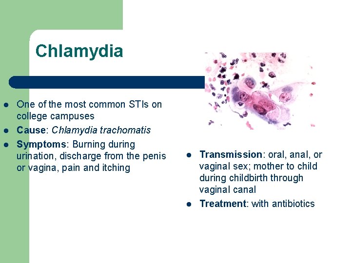 Chlamydia l l l One of the most common STIs on college campuses Cause: