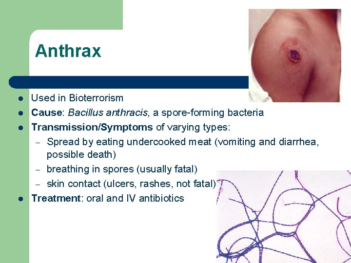 Anthrax l l Used in Bioterrorism Cause: Bacillus anthracis, a spore-forming bacteria Transmission/Symptoms of