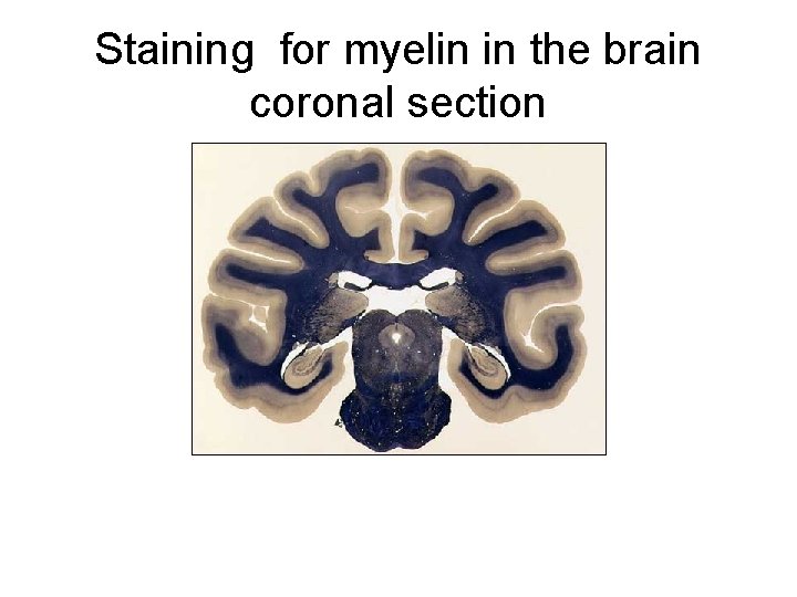 Staining for myelin in the brain coronal section 
