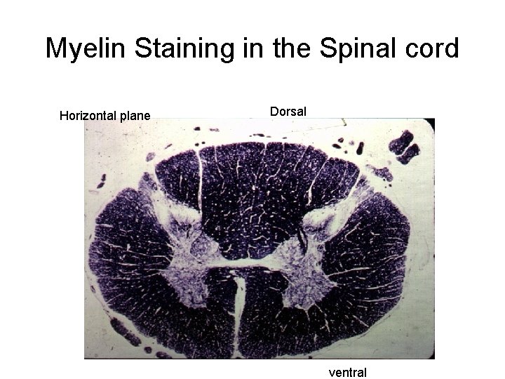 Myelin Staining in the Spinal cord Horizontal plane Dorsal ventral 