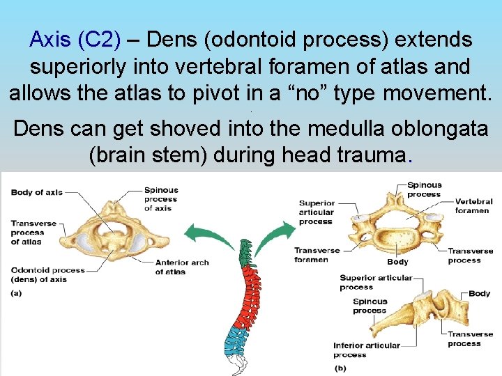 Axis (C 2) – Dens (odontoid process) extends superiorly into vertebral foramen of atlas