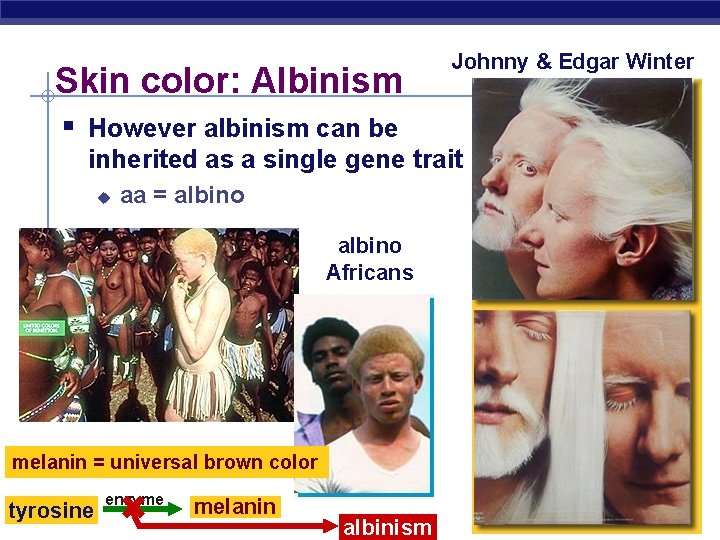 Skin color: Albinism Johnny & Edgar Winter § However albinism can be inherited as