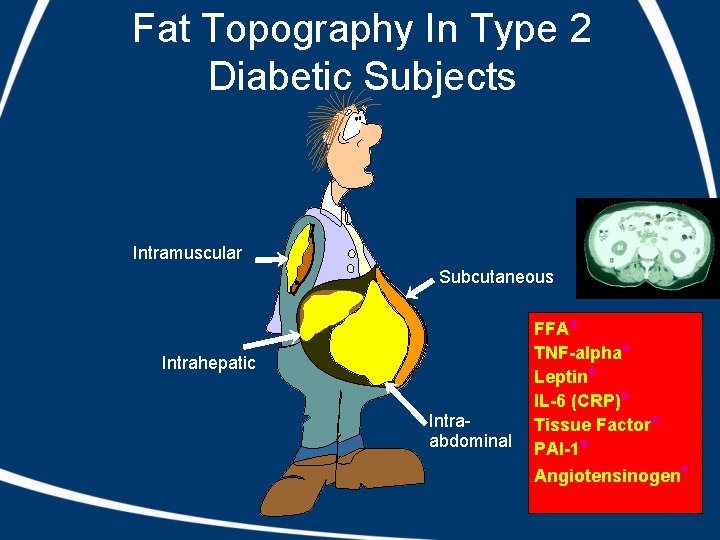 Fat Topography In Type 2 Diabetic Subjects Intramuscular Subcutaneous Intrahepatic Intraabdominal FFA* TNF-alpha* Leptin*