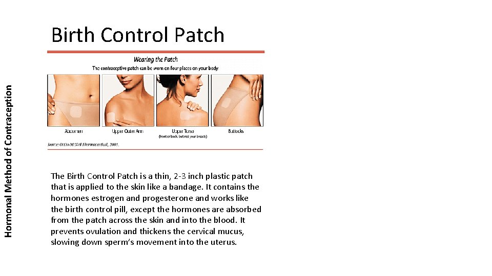 Hormonal Method of Contraception Birth Control Patch The Birth Control Patch is a thin,
