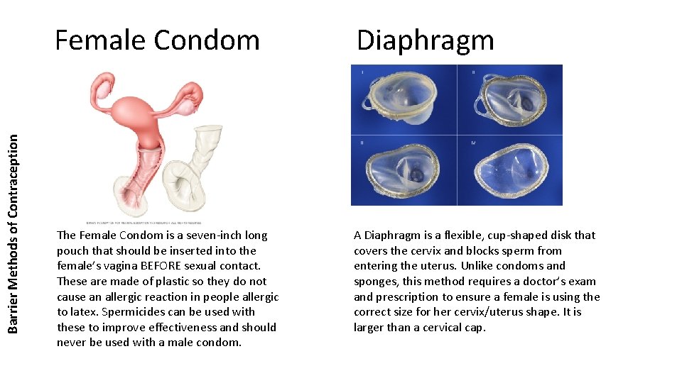Barrier Methods of Contraception Female Condom Diaphragm The Female Condom is a seven-inch long