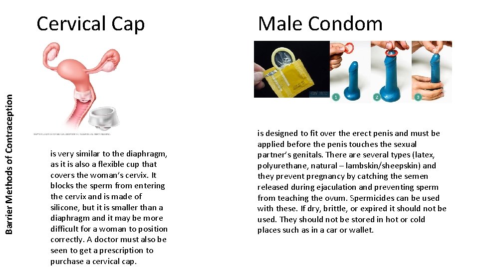 Barrier Methods of Contraception Cervical Cap is very similar to the diaphragm, as it