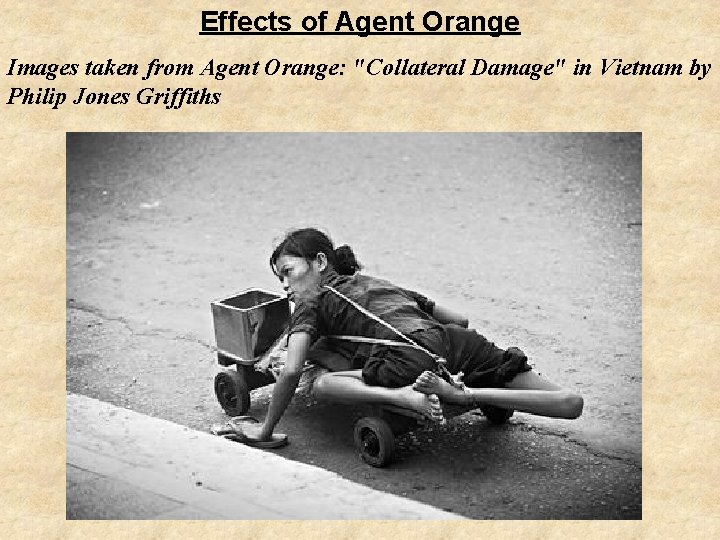 Effects of Agent Orange Images taken from Agent Orange: "Collateral Damage" in Vietnam by