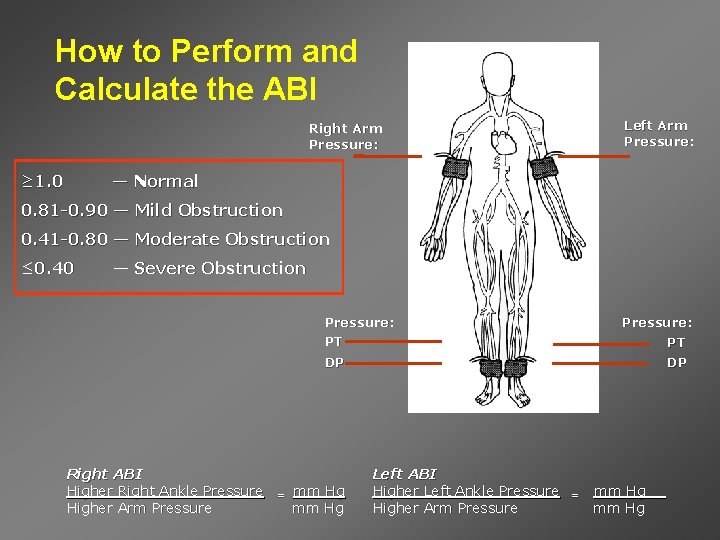How to Perform and Calculate the ABI Left Arm Pressure: Right Arm Pressure: ≥