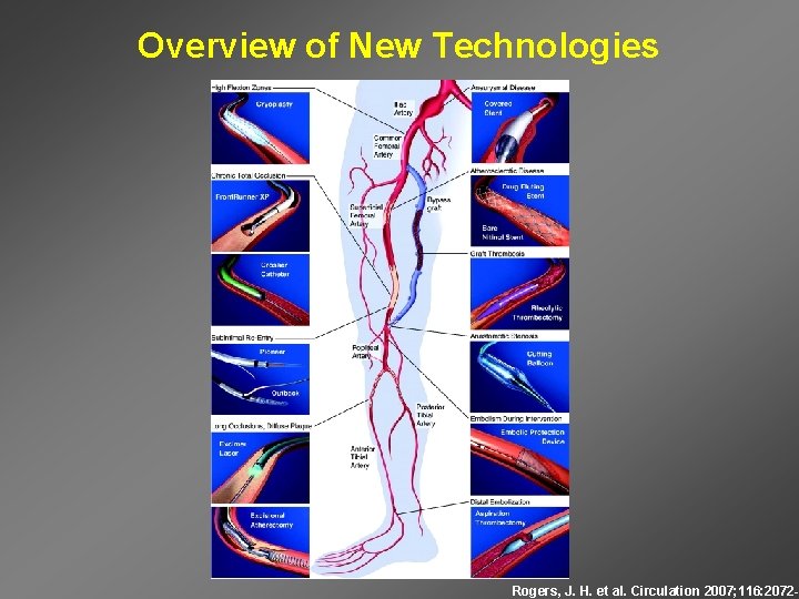Overview of New Technologies Rogers, J. H. et al. Circulation 2007; 116: 2072 -