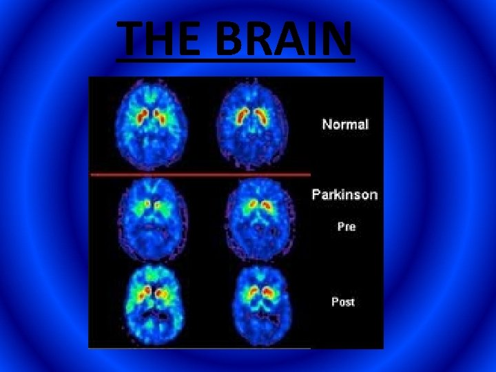 THE BRAIN 