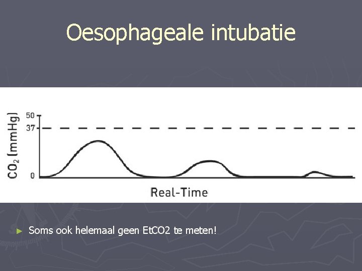 Oesophageale intubatie ► Soms ook helemaal geen Et. CO 2 te meten! 