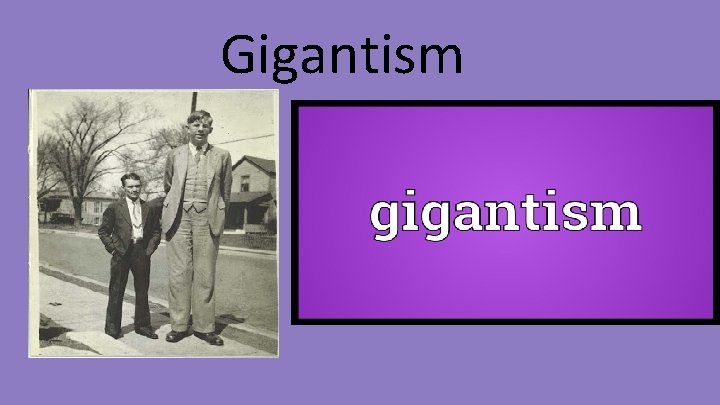 Gigantism 