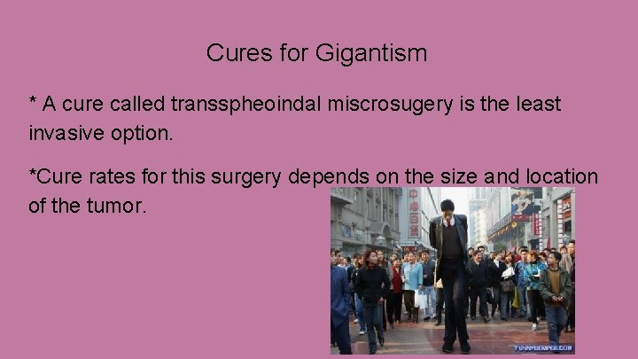 Cures for Gigantism * A cure called transspheoindal miscrosugery is the least invasive option.