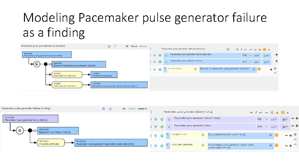 Modeling Pacemaker pulse generator failure as a finding 