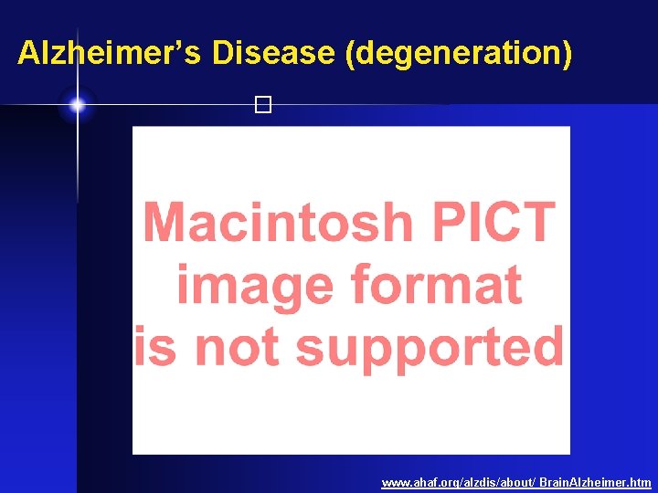 Alzheimer’s Disease (degeneration) � www. ahaf. org/alzdis/about/ Brain. Alzheimer. htm 