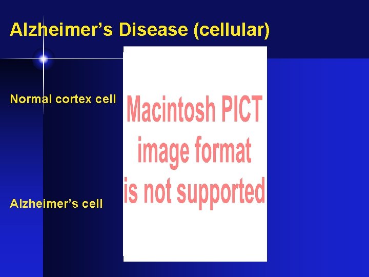 Alzheimer’s Disease (cellular) � Normal cortex cell Alzheimer’s cell 