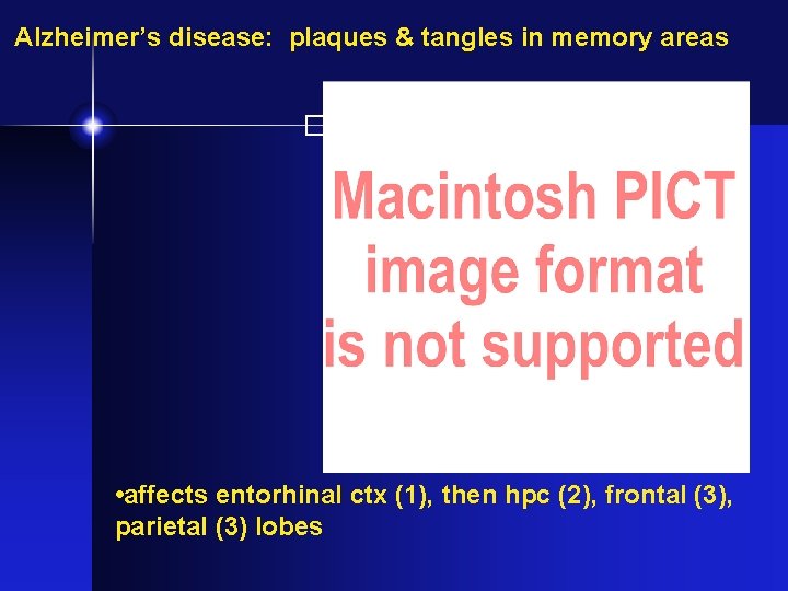 Alzheimer’s disease: plaques & tangles in memory areas � • affects entorhinal ctx (1),