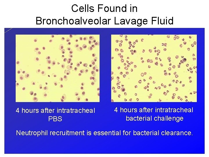 Cells Found in Bronchoalveolar Lavage Fluid 4 hours after intratracheal PBS 4 hours after