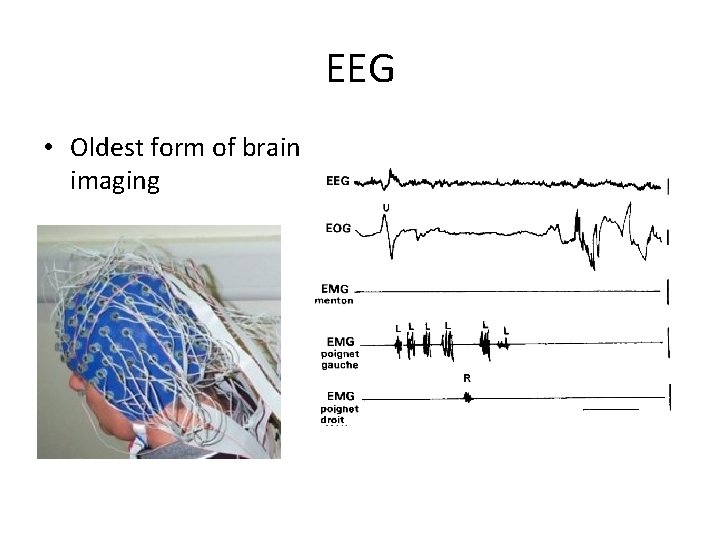 EEG • Oldest form of brain imaging 