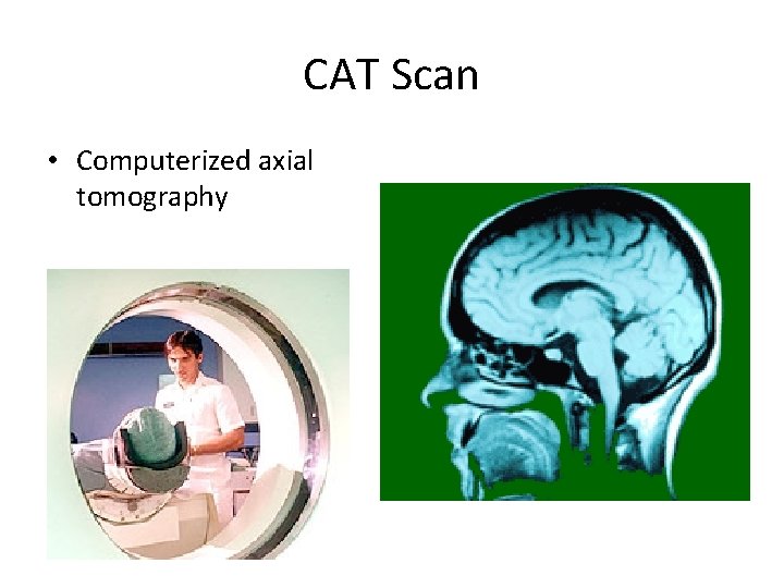 CAT Scan • Computerized axial tomography 