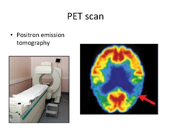 PET scan • Positron emission tomography 