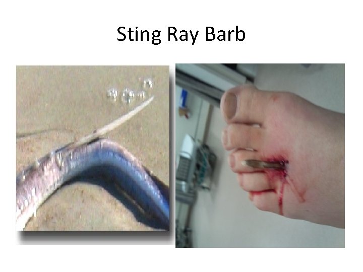 Sting Ray Barb 