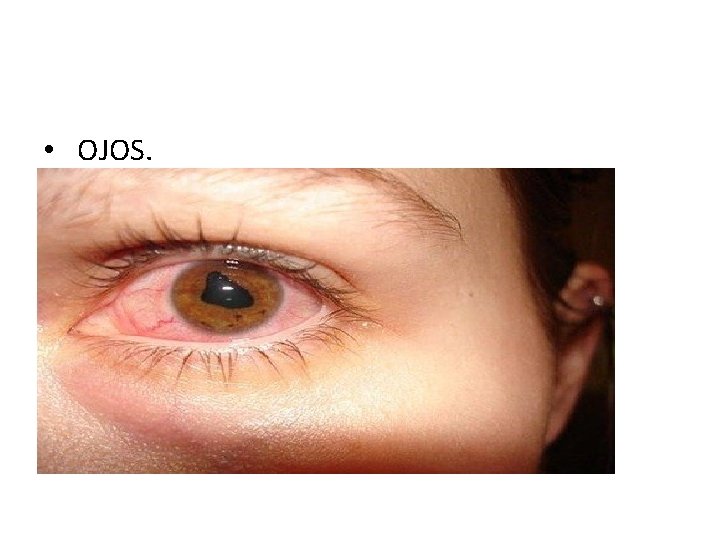  • OJOS. 