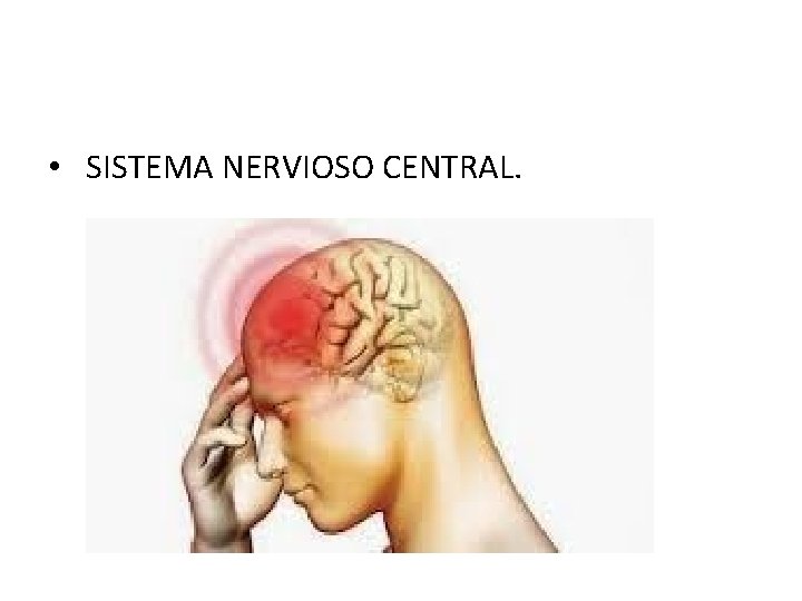  • SISTEMA NERVIOSO CENTRAL. 