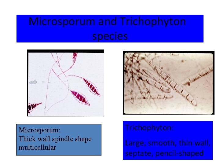 Microsporum and Trichophyton species Microsporum: Thick wall spindle shape multicellular Trichophyton: Large, smooth, thin