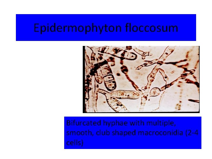 Epidermophyton floccosum Bifurcated hyphae with multiple, smooth, club shaped macroconidia (2 -4 cells) 