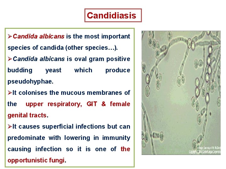 Candidiasis ØCandida albicans is the most important species of candida (other species…). ØCandida albicans