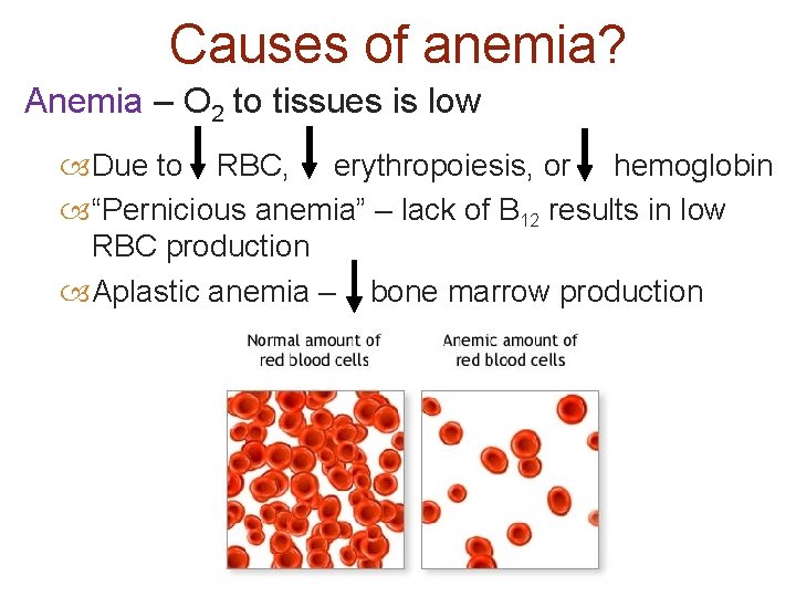 Causes of anemia? Anemia – O 2 to tissues is low Due to RBC,