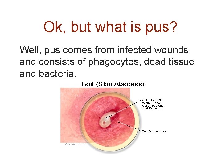 Ok, but what is pus? Well, pus comes from infected wounds and consists of