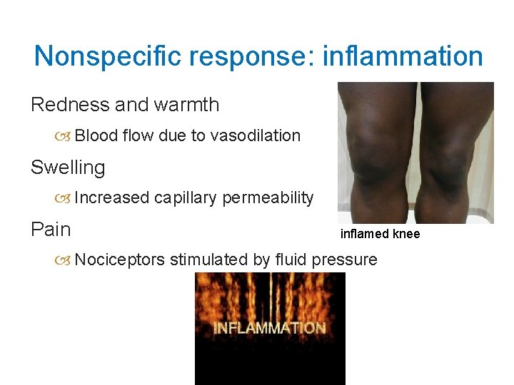 Nonspecific response: inflammation Redness and warmth Blood flow due to vasodilation Swelling Increased capillary