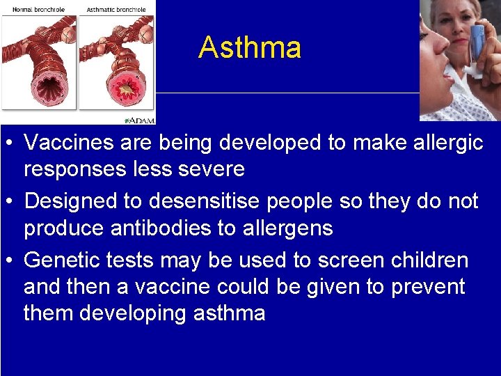 Asthma • Vaccines are being developed to make allergic responses less severe • Designed