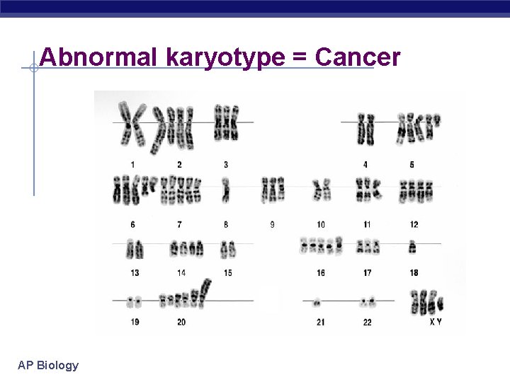 Abnormal karyotype = Cancer AP Biology 