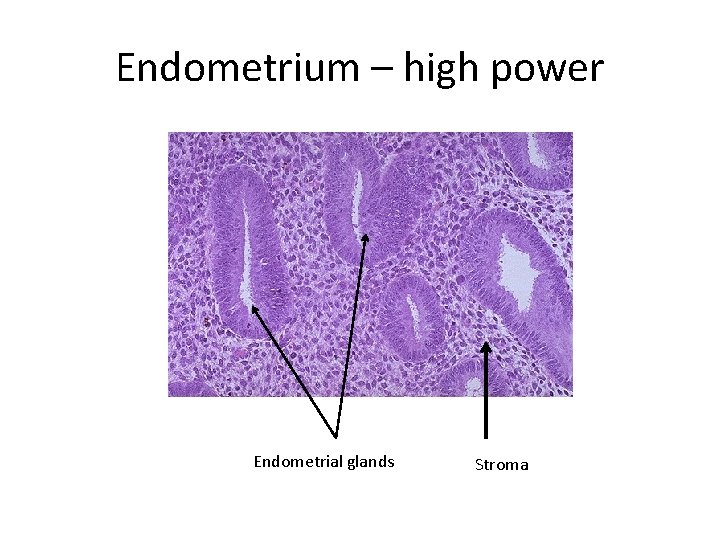 Endometrium – high power Endometrial glands Stroma 