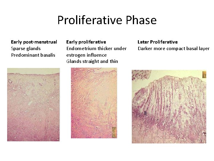 Proliferative Phase Early post-menstrual Sparse glands Predominant basalis Early proliferative Endometrium thicker under estrogen