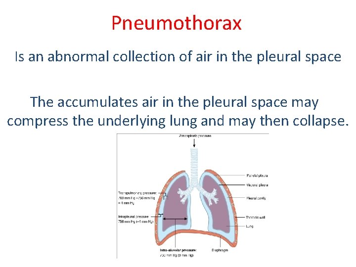 Pneumothorax Is an abnormal collection of air in the pleural space The accumulates air