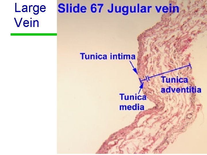 Large Vein 20 