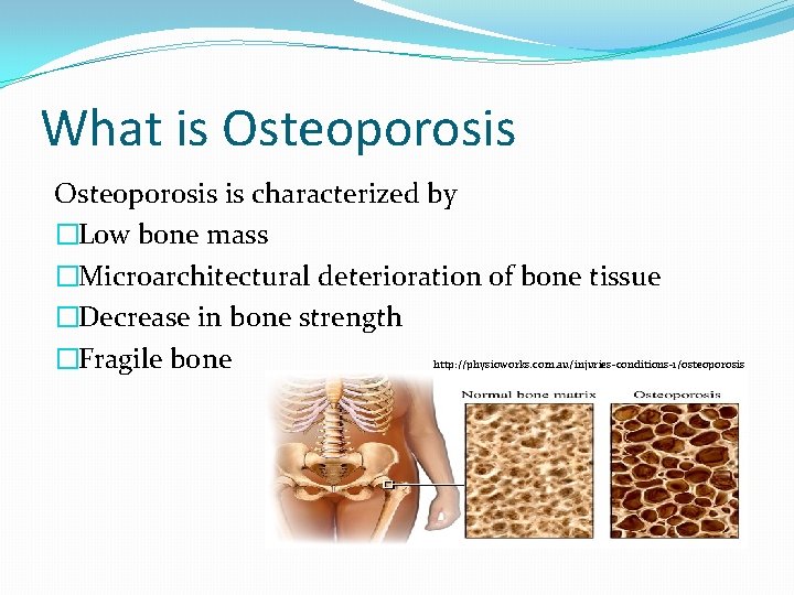 What is Osteoporosis is characterized by �Low bone mass �Microarchitectural deterioration of bone tissue