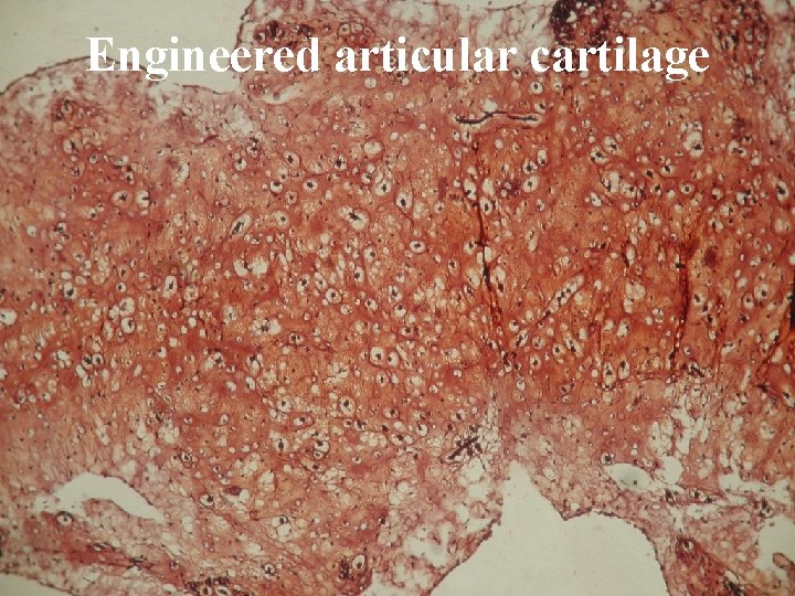 Engineered articular cartilage 
