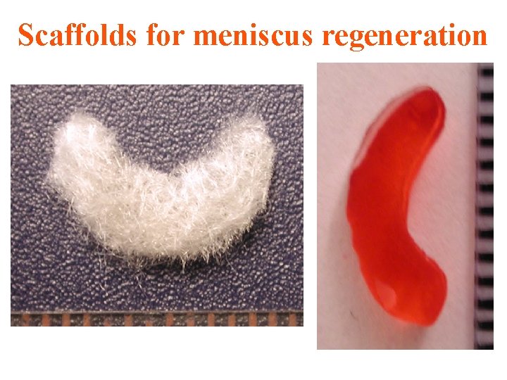 Scaffolds for meniscus regeneration 