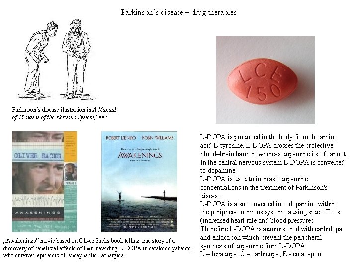 Parkinson’s disease – drug therapies Parkinson’s disease ilustration in A Manual of Diseases of