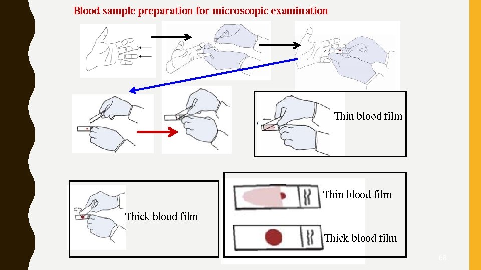 Blood sample preparation for microscopic examination Thin blood film Thick blood film 68 