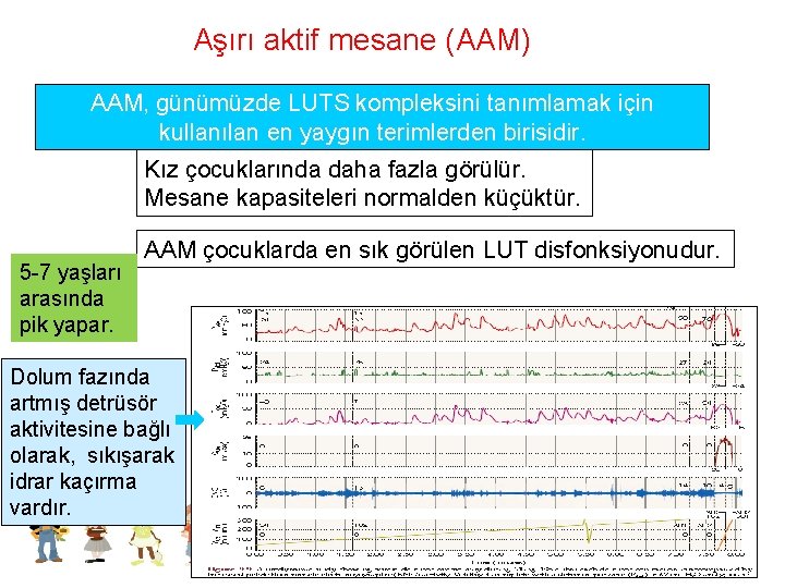 Aşırı aktif mesane (AAM) AAM, günümüzde LUTS kompleksini tanımlamak için kullanılan en yaygın terimlerden