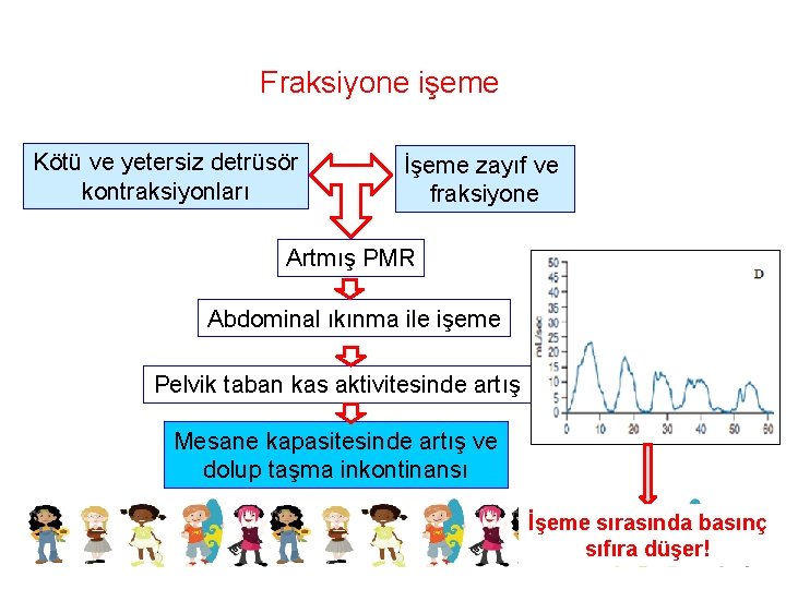 Fraksiyone işeme Kötü ve yetersiz detrüsör kontraksiyonları İşeme zayıf ve fraksiyone Artmış PMR Abdominal