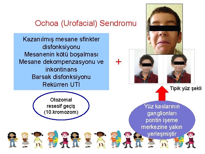 Ochoa (Urofacial) Sendromu Kazanılmış mesane sfinkter disfonksiyonu Mesanenin kötü boşalması Mesane dekompenzasyonu ve inkontinans