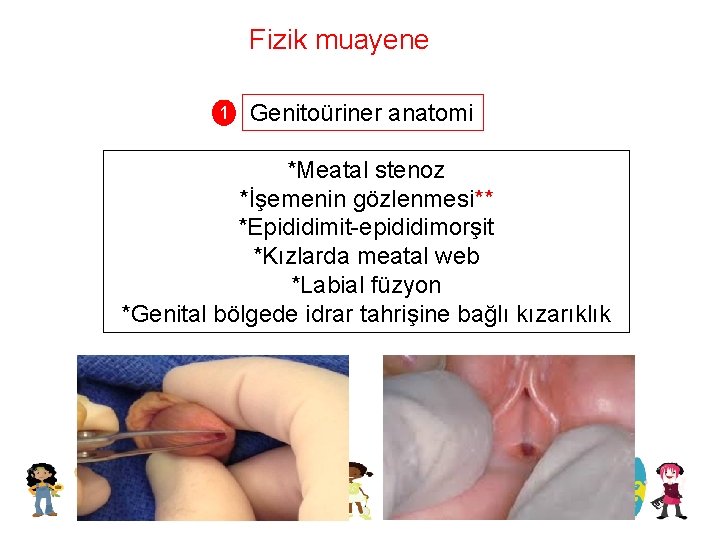 Fizik muayene 1 Genitoüriner anatomi *Meatal stenoz *İşemenin gözlenmesi** *Epididimit-epididimorşit *Kızlarda meatal web *Labial